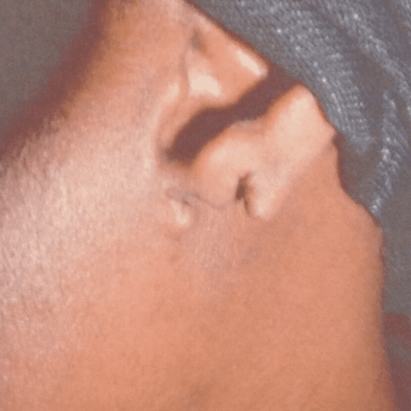 A close up of a man's ear.